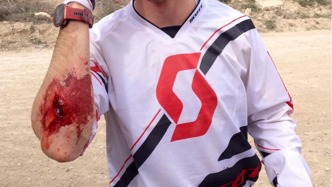 Terol cade facendo motocross: 6 punti al braccio