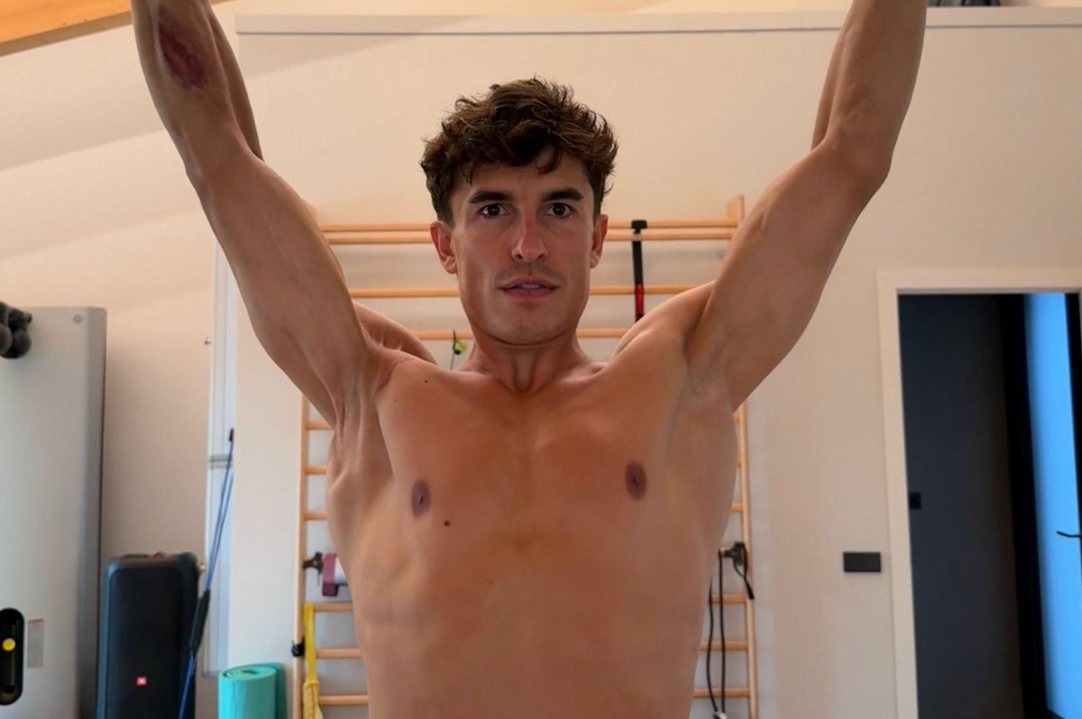 Ce que cache la photo du bras de Marc Márquez