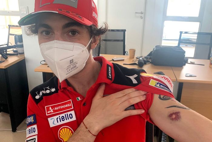 Francesco Bagnaia, Ducati Team, con una herida en el brazo por una piedra