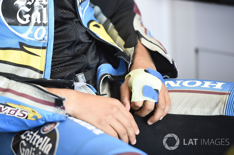 Cedera di tangan Franco Morbidelli, Estrella Galicia 0,0 Marc VDS